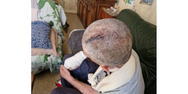 Francja: Firminy. Nożownik zaatakował kilka osób przed pizzerią w centrum miasta