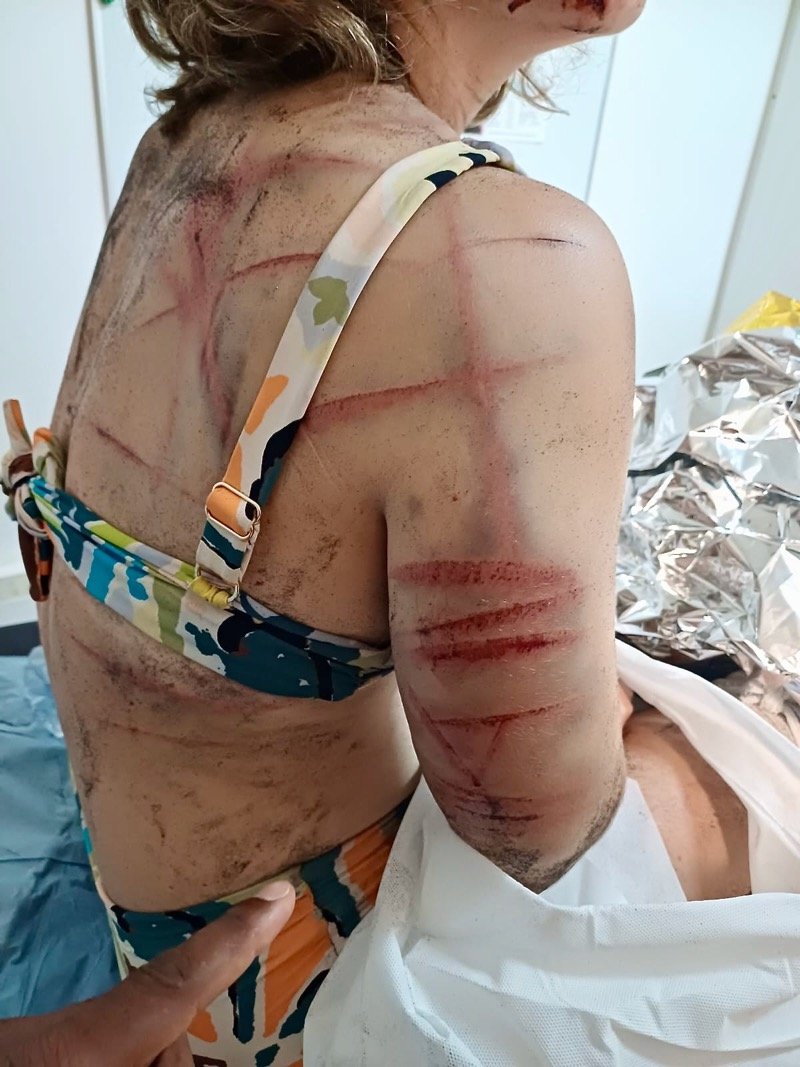 Francja: Majotta. Umorzono sprawę Komorczyka za atak maczetą