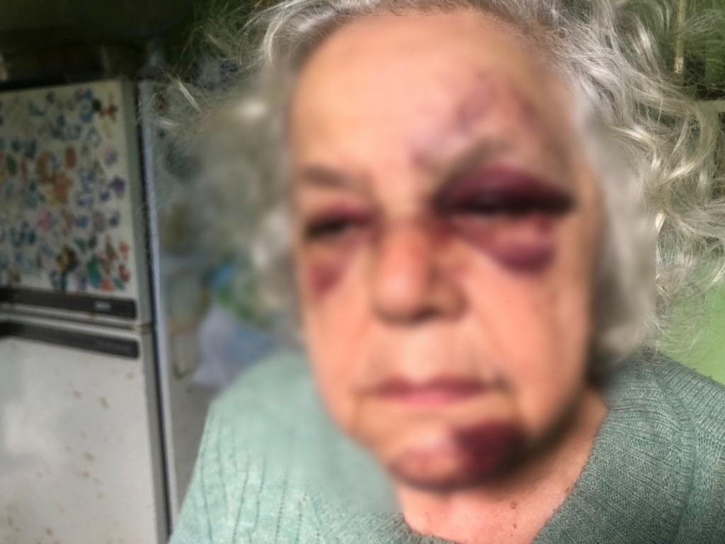 🇫🇷Francja: Ormoy-la-Rivière. Zamaskowani nastolatkowie pobili i okradli 80-letnią kobietę