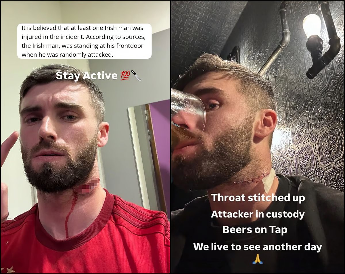 Irlandia: Dublin. Ofiara ataku nożownika dzień po zdarzeniu wraca do pubu na piwo