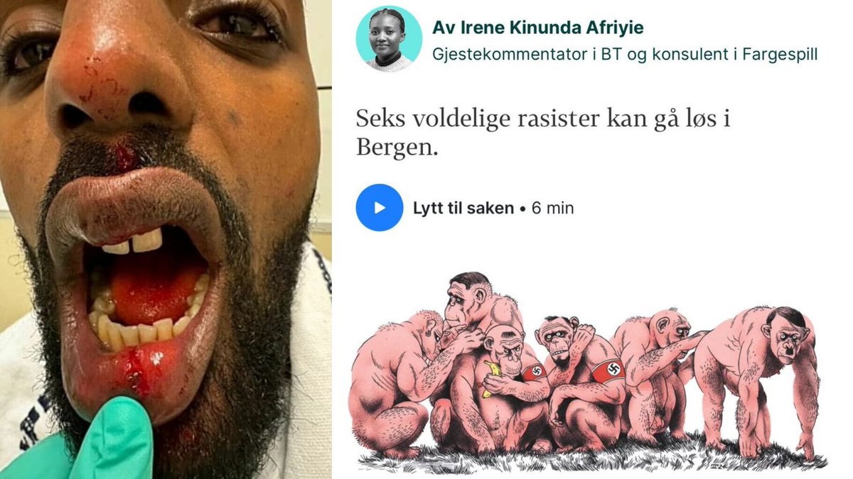 🇳🇴Norwegia: Bergen. Sąd uniewinnił mężczyznę po błędnej relacji o rasistowskim ataku