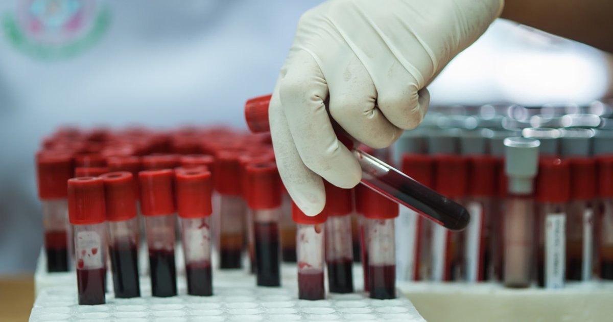 🇵🇱Polska: Liczba zakażeń HIV rośnie coraz szybciej
